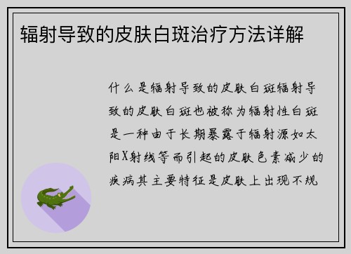 辐射导致的皮肤白斑治疗方法详解